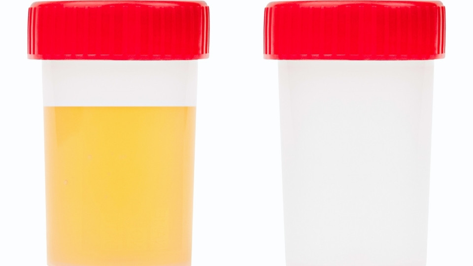 How Long Does OxyContin Stay in Your System a typically urine test will pick up use within 2-4 days.