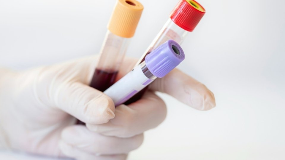 how long does cocaine stay in your system in a blood test it is detectable for a few days.