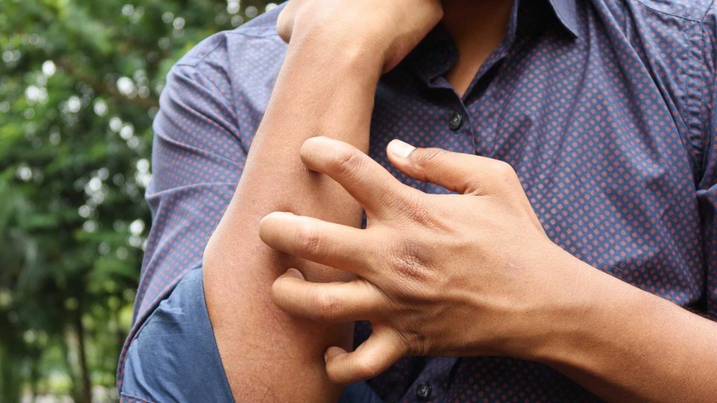 does oxycodone make you itch? It can though you should also be wary of allergic reactions