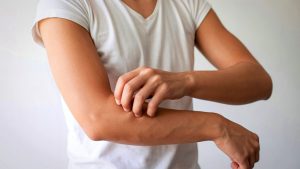 does oxycodone make you itch Yes it is a common symptom of use