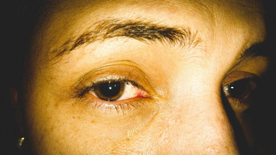 signs of cocaine use include tell tale signs like enlarged pupils.